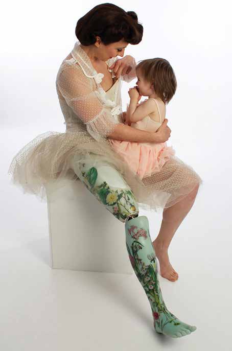 Image of a woman wearing a pink dress with a prostetic leg with a picture of flowers on it. She carries a child on her lap.