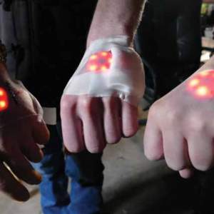 Three people hold their hands out to show lighted implants under the skin on the backs of their hands. 