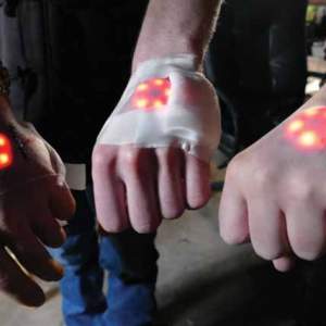 Three people hold their hands out to show lighted implants under the skin on the backs of their hands.